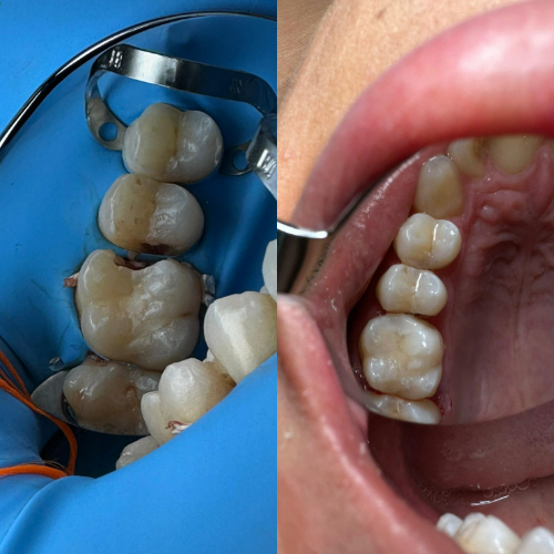 Dentística